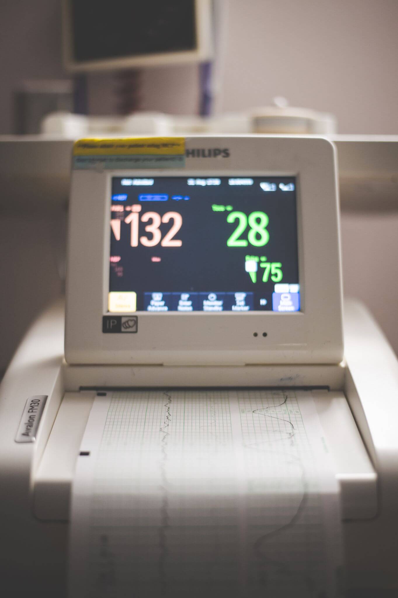 Detailed view of a medical display screen showing heart rate data in a clinical setting.